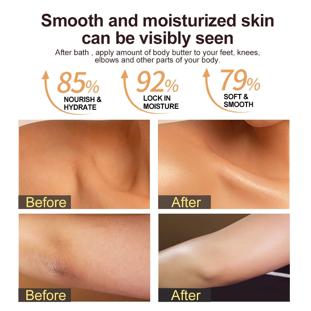Shea Body Butter Soothes Dry Skin Moisturizer Smooth Hydration Cream